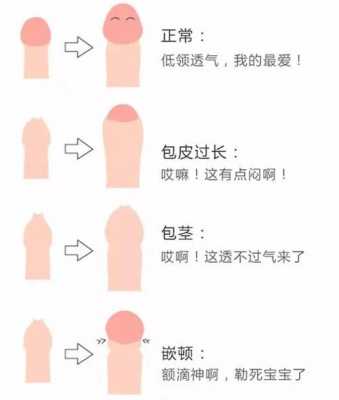 砗长什么样（长什么样子长需要割包皮）-图1