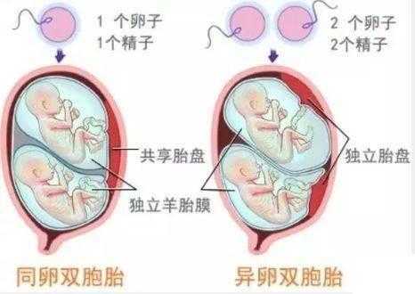 什么叫双包胎号（什么是双包胎）-图2